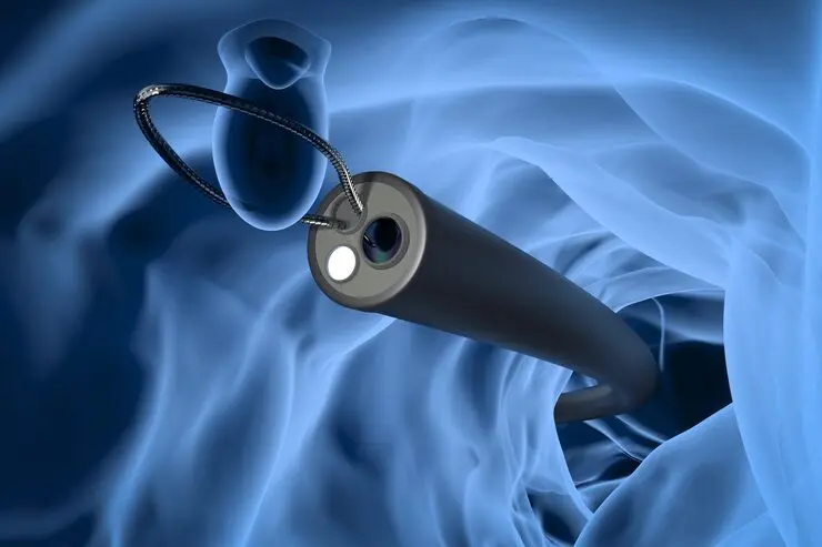 3d-rendering-x-ray-endoscope-remove-colonic-polyp-with-wire-loop_493806-3293